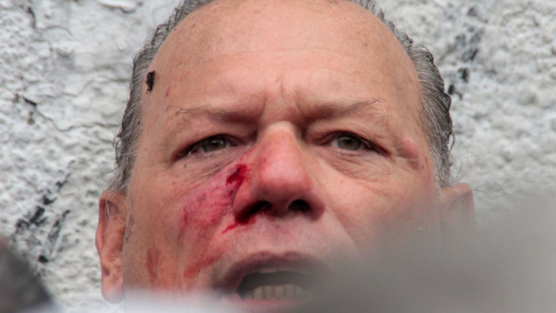 Berni toma licencia para finalizar sus estudios médicos